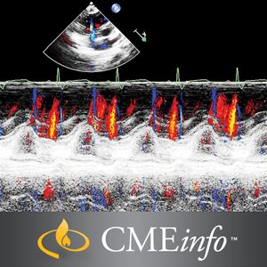 Echocardiography – A Comprehensive Review