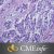 Soft Tissue Tumors: Masters of Pathology Series